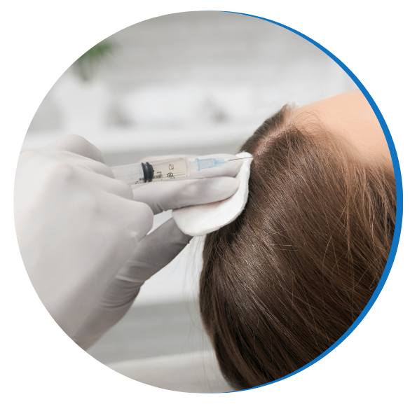 PRP Treatment - img1